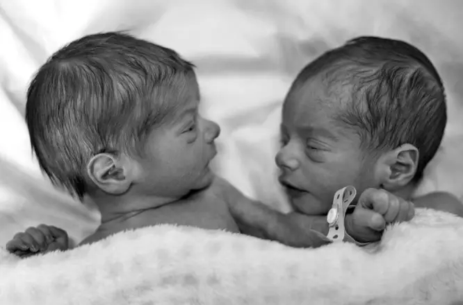 natural twins birth story