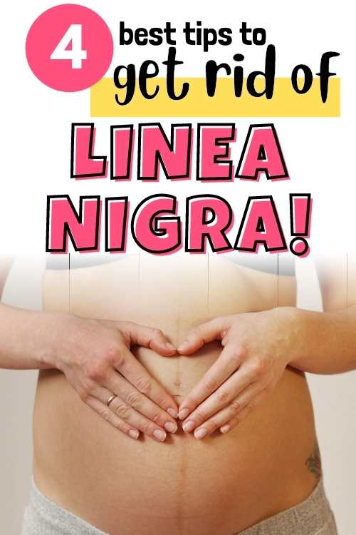 how to get rid of linea nigra