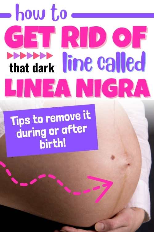 how to get rid of pregnancy lnie on stomach