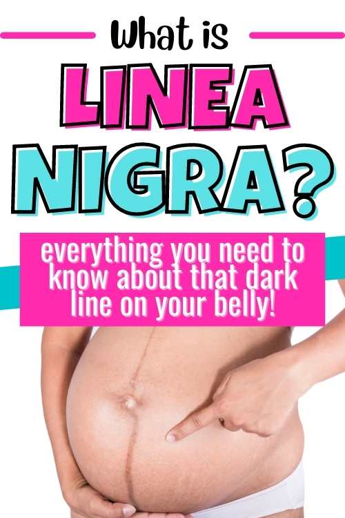 what is linea nigra