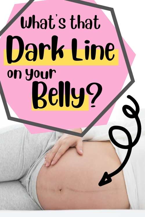 what-s-that-pregnancy-line-on-stomach-linea-nigra-explained